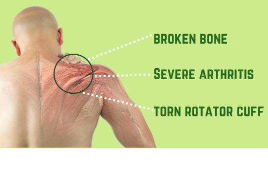 Why Get A Total Shoulder Replacement Surgery?